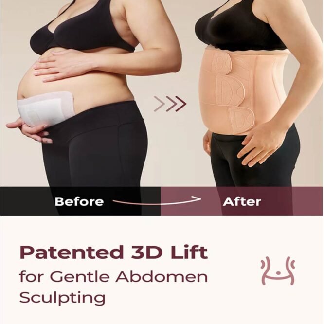 Momcozy Ergowrap Postpartum Belly Wrap - Postpartum Belly Band - L